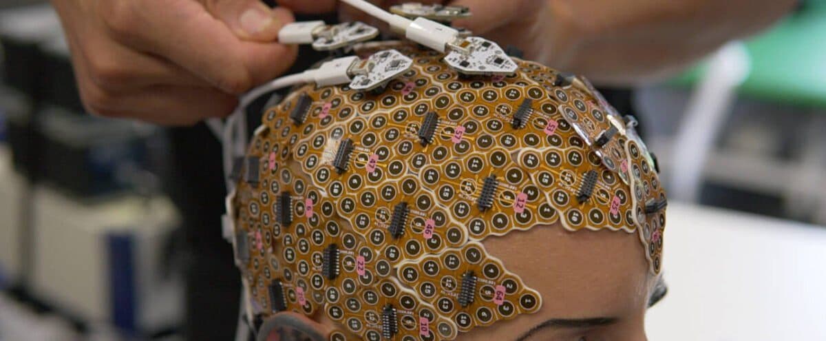 Bir katılımcının kafa derisine yapıştırılmış, yüzlerce numaralı elektrottan oluşan altın renkli g.Pangolin elektrot ızgaraları ve onlara takılan kablolar